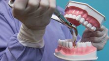 Advanced Dental Esthetics dental implants