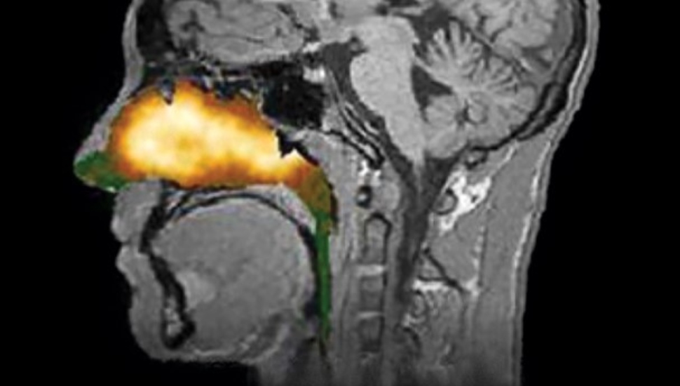 xray of a head