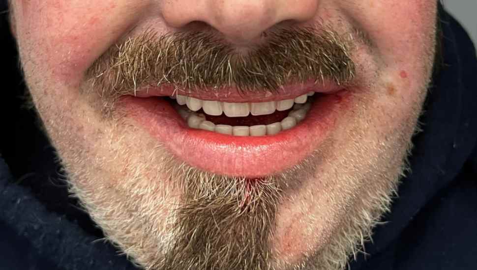 mustashioed man smiling