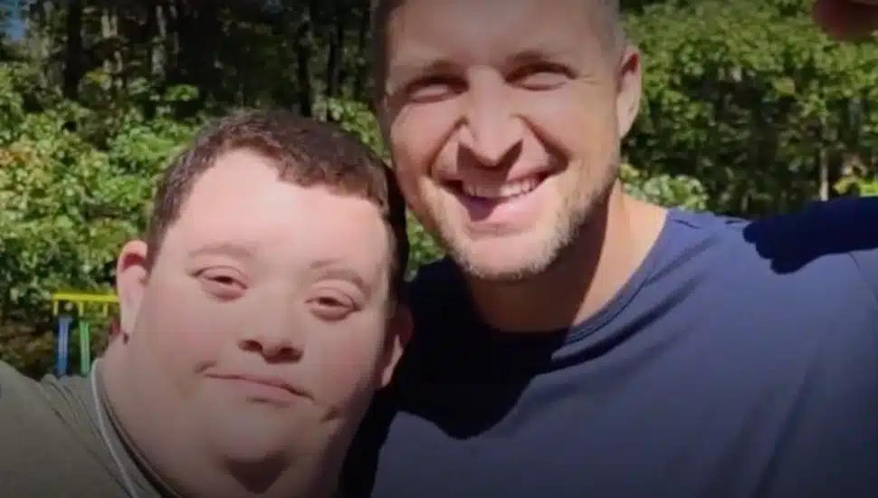 Down syndrome