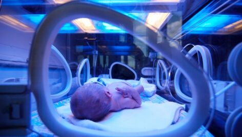A baby in an incubator