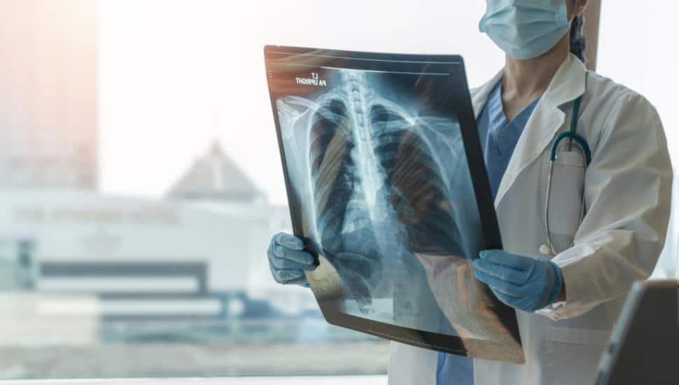 Doctor looking at an x-ray of a chest.